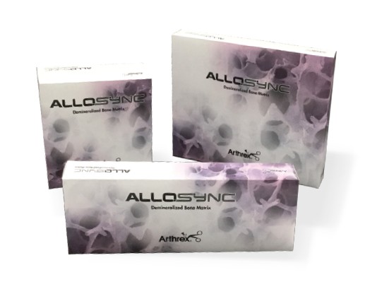 Arthrex Allosync